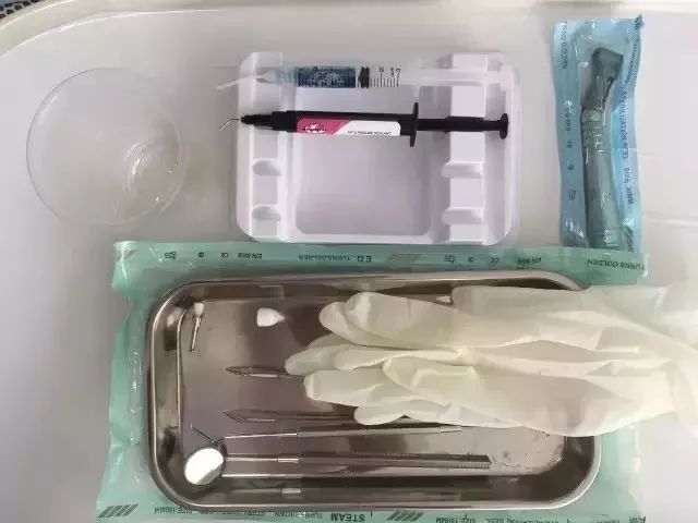 进行防龋齿牙齿窝沟封闭工作,窝沟封闭是保护牙齿最有效的方式