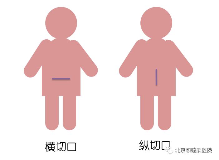 聊聊孕期那些事,聊聊怀孕那点事