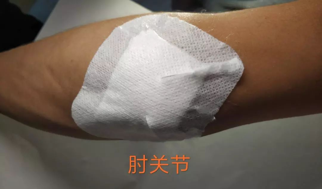 特殊敷料敷贴,手术缝合口粘贴敷料使用方法