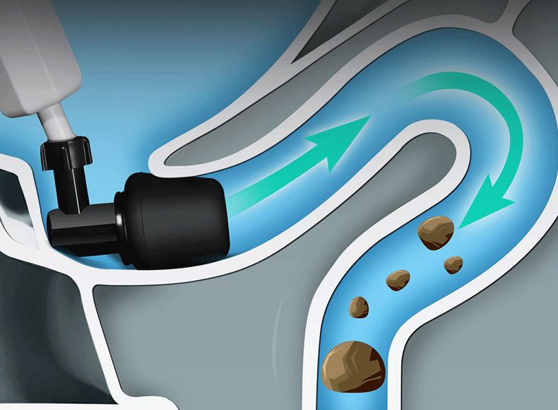 马桶堵塞一炮就通,马桶堵塞下水道一炮通