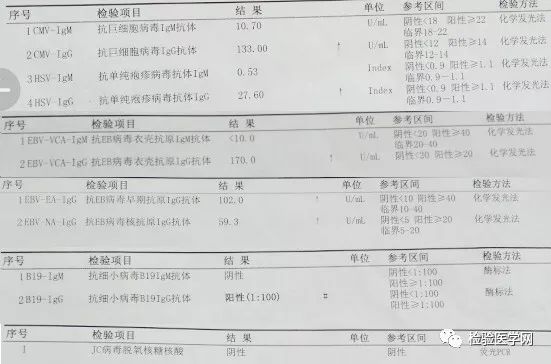 看懂血常规报告单只需明白这四项,宝宝做血常规要注意什么