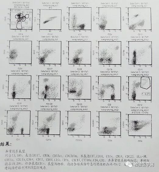 看懂血常规报告单只需明白这四项,宝宝做血常规要注意什么