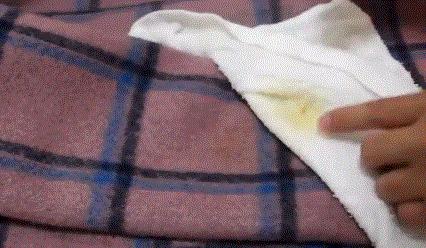 夏天来了衣服上潮湿有霉斑怎么办,衣服发霉了怎么洗掉霉斑小妙招