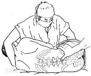 医生不可以做的事,血液科一般都做哪些检查呢