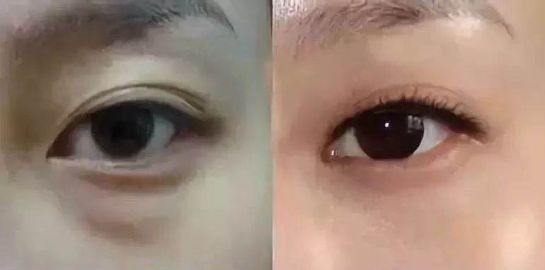 马应龙八宝眼袋型眼膜,马应龙八宝多肽眼膜