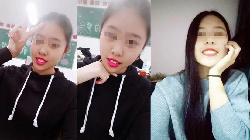 矫正牙齿不给报销吗,牙齿矫正为什么不能纳入医保