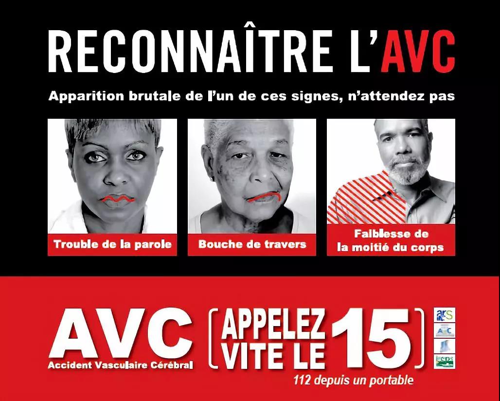 儿童会发生中风吗,小孩也会中风吗