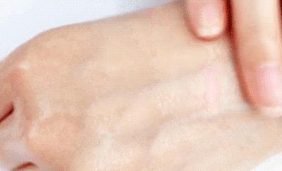 适合黄皮的mm面膜,适合黄皮便宜好用面膜