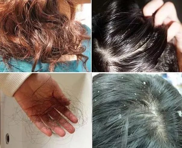 网红洗发水推荐去屑氨基酸,网红爆款洗发水控油清爽持久留香