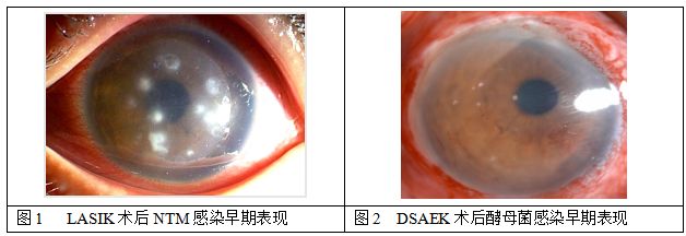 孙旭光眼科医生,孙旭光大夫角膜塑形镜危害