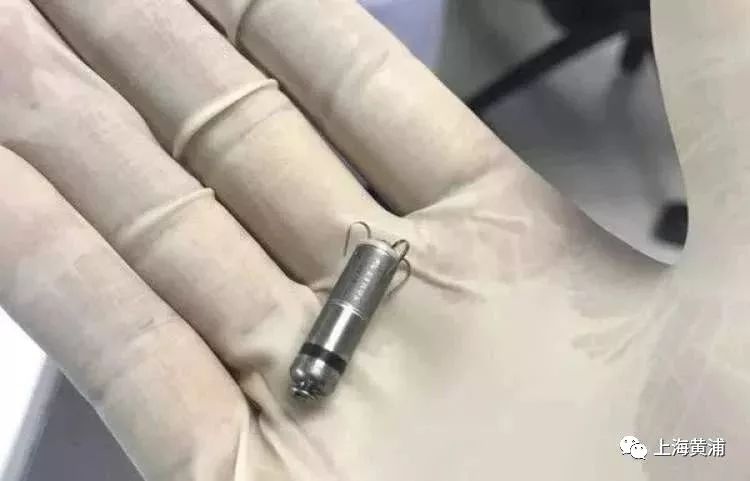 世界上最小的起搏器进博会,进博会现心脏起搏器