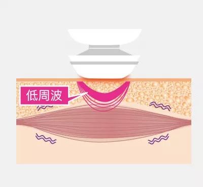 科普今年最火的美容仪真的有用吗,最近很火的美容仪有什么区别