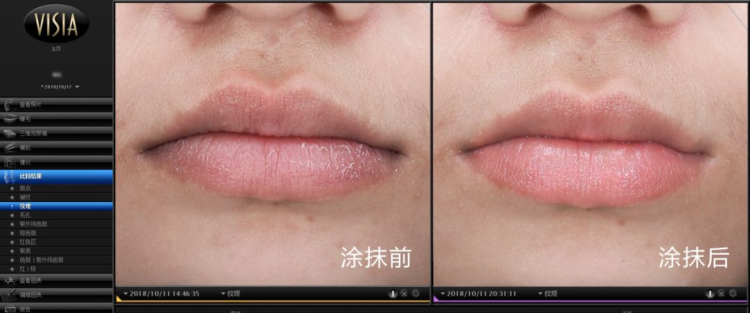 唇干去死皮的唇膏,干唇星人的急救小能手