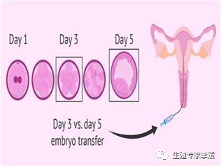 试管婴儿的具体步骤是什么呢,试管婴儿的过程和注意事项