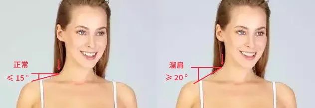 在家如何矫正圆肩溜肩,溜肩圆肩训练方法视频