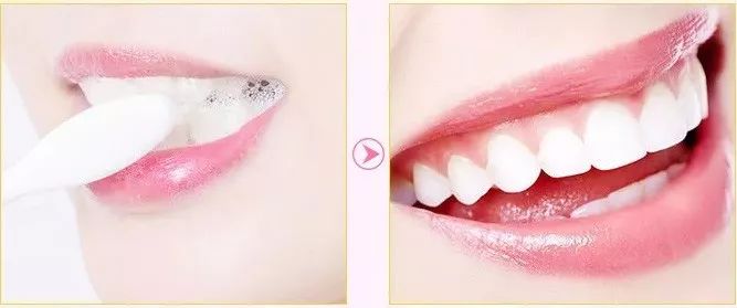 闭着嘴巴一会就干有异味,闭着嘴巴都感觉口腔有异味