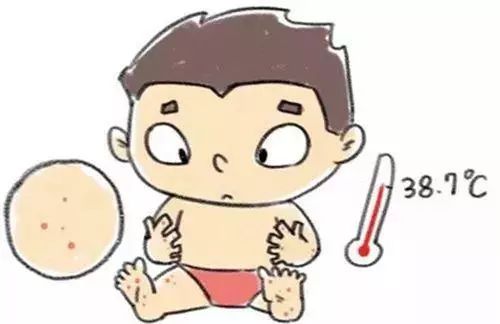 水痘高发期来临时刻准备战痘,水痘高发期请做好战痘准备