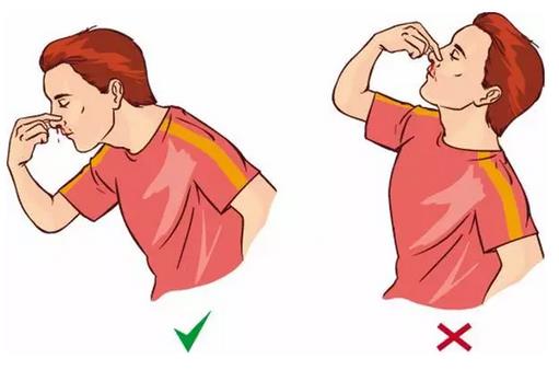 鼻子爱出血中医如何解释,冬天鼻子流血正确止血方式