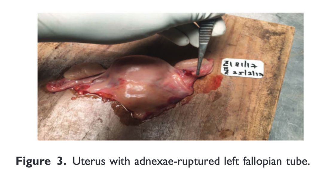 聊聊怀孕这些事,怀孕这件大事儿