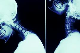 低头看手机颈托,低头看手机脖子相当于承受多少斤