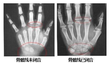 孩子才18岁长高缓慢怎样补救,青春期孩子长高的最佳方法