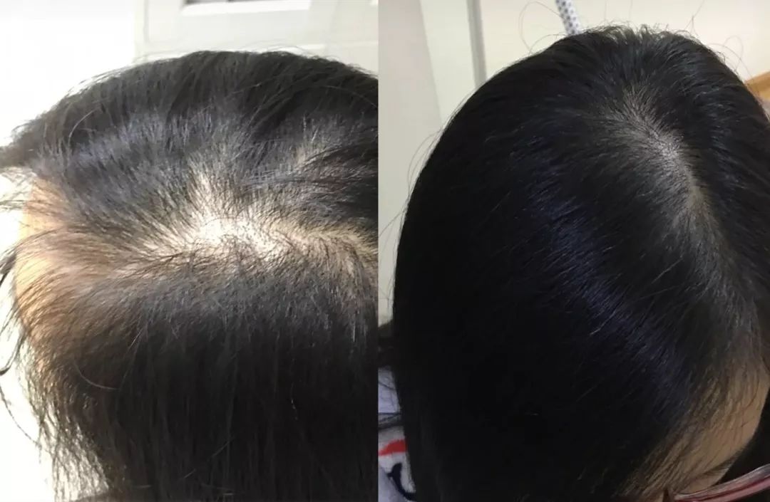 额前新长出的碎发怎么办,额前碎发长出来了