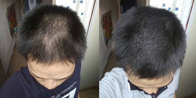 额前新长出的碎发怎么办,额前碎发长出来了