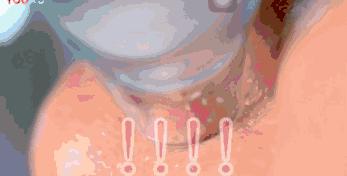 辣眼睛，有人用它吸出一整年的黑头，看完我果断下单了！