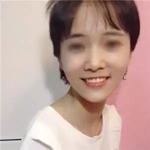 种植牙能降价多少钱啊,牙齿种植牙价格一览表