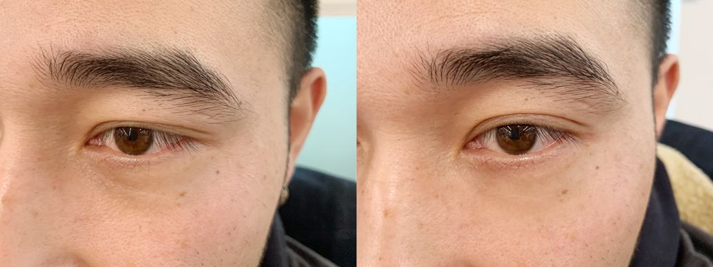 神奇的原液去皱纹眼袋,眼袋抗皱纹精华液