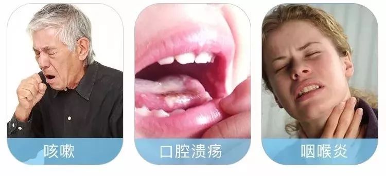 20年烟民咽喉发黑,瑞士专业医师推荐!一喷杀菌99.9%,止咳清痰排烟毒