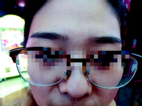 相信文眉开运背数万*款贷**一女子花8.3万美容发现眉毛掉色嘴唇起皮