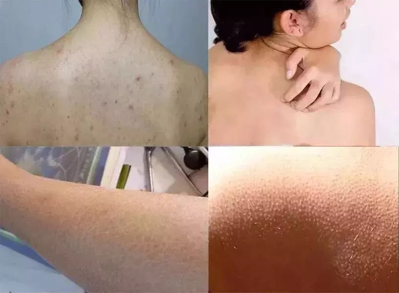 团购开抢｜嫩出水、白成雪、滑溜溜的肌肤，靠这款身体乳就够了