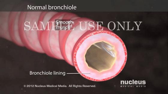 男子哮喘发作喘不过气,哮喘发作呼吸不顺畅