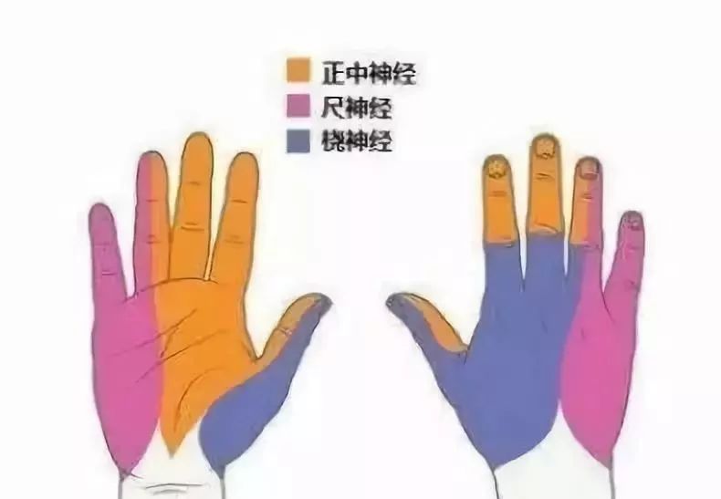 康复锻炼手麻是怎么回事,手麻的治疗思路这5个点要记住