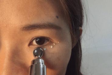 眼袋松弛下垂最快解决方法,严重眼袋下垂松弛怎么恢复