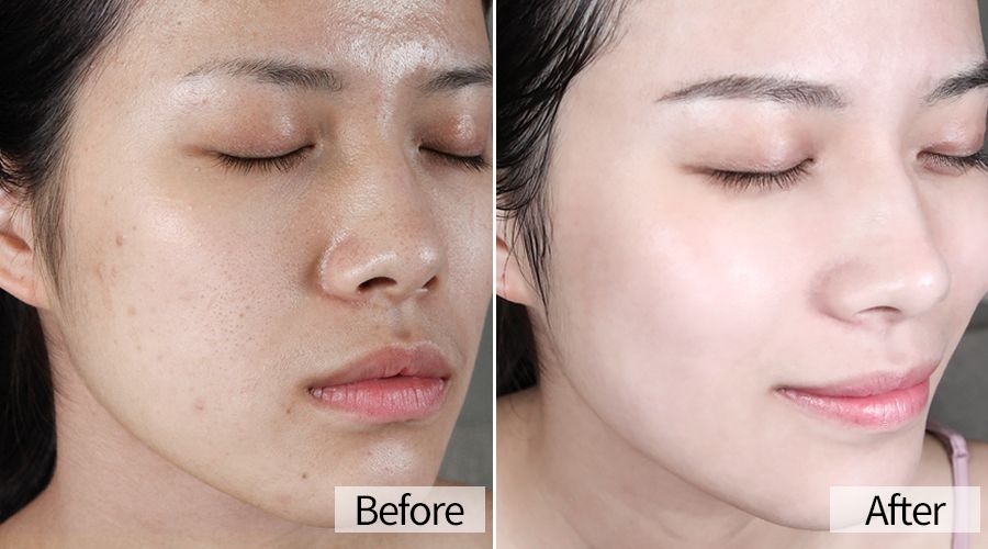 老公嫌老婆丑我们有小三怎么办,老公嫌我丑找小三