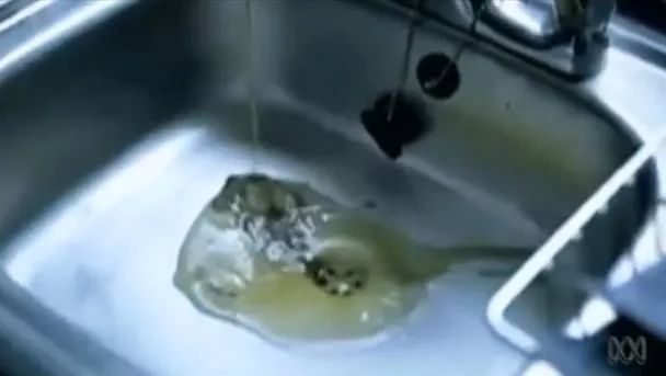 不要妖魔化胆固醇,胆固醇是本世纪最大谎言