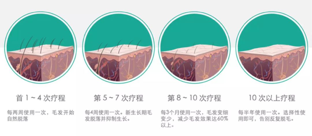脱毛没那么复杂来这里三步搞定,这才是夏天脱毛的正确打开方式