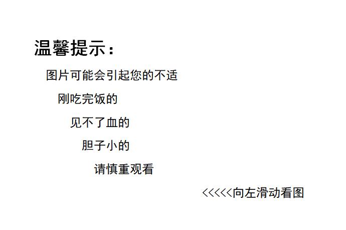 被“它”折磨的女性越来越多！医生看到她子宫里的东西——彻底惊呆了！