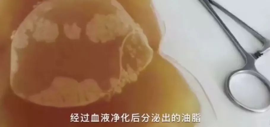 跟着明星吃胶原蛋白,跟着明星吃一天体重会有什么变化