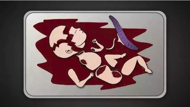 多次打胎真实案例,25岁女生接受多少次打胎