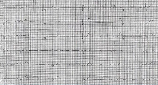 挑战心率检测仪,心率挑战