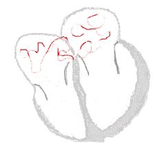 专家讲房颤治疗方法,专家医生谈房颤