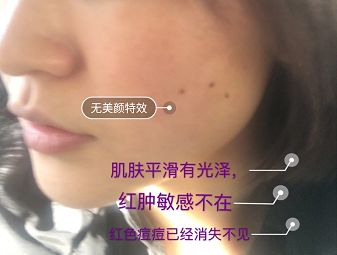 鍚冪硸闀跨棙鍙橀粦,鍚冪硸鍙橀粦闀跨棙