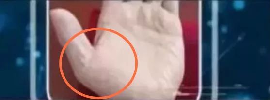 手上突然有青筋是什么原因,突然看到手上有青筋什么原因