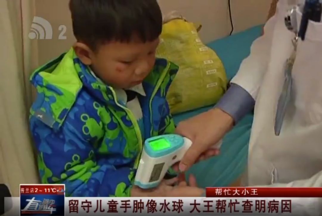 帮忙大小王|留守儿童手肿像水球大王帮忙查明病因