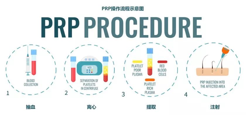 张雨绮猪油抹脸,张雨绮猪油膏