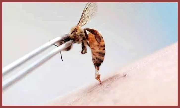 张雨绮猪油抹脸,张雨绮猪油膏