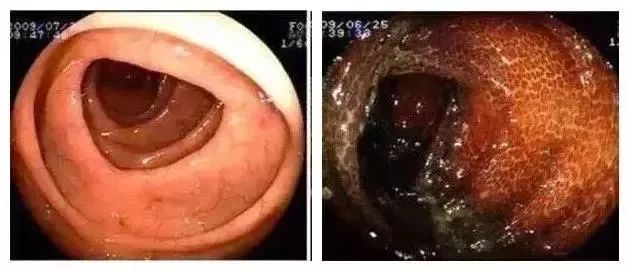 比贩毒更暴利的商机,比贩毒还暴利的十个行业